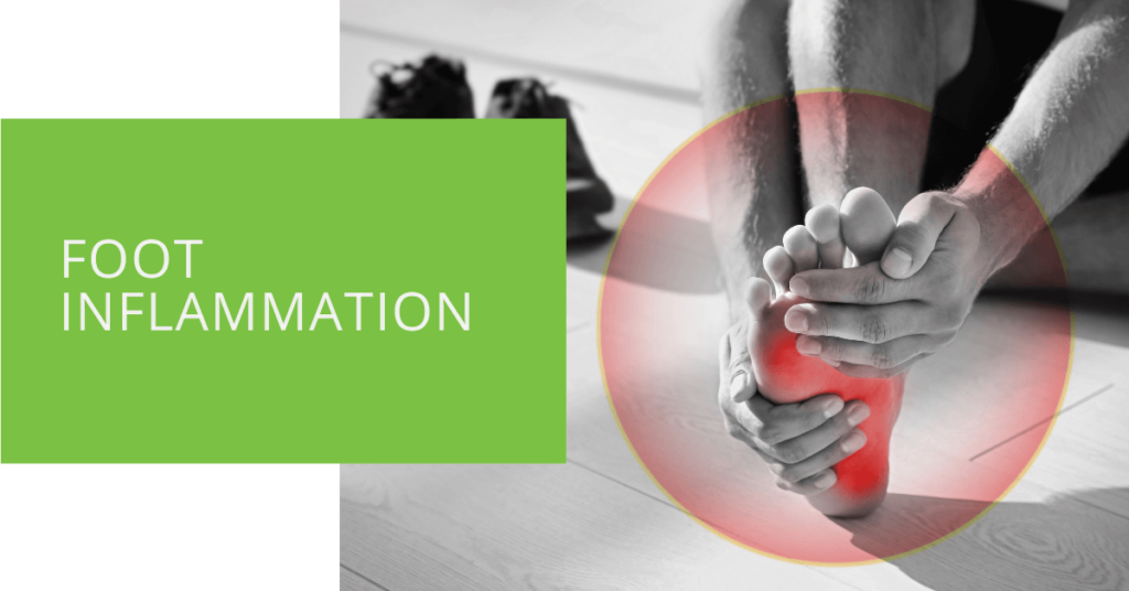 Foot Inflammation