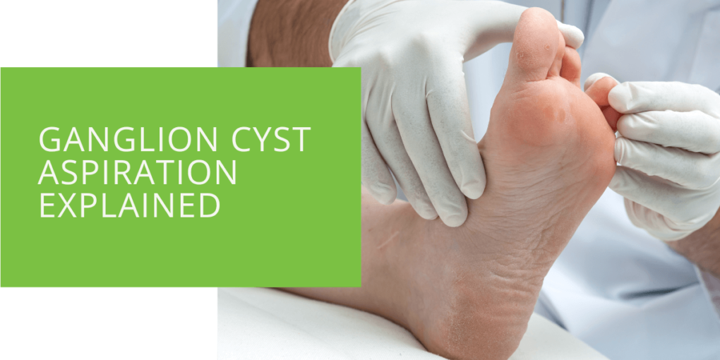 Ganglion Cyst Aspiration Explained
