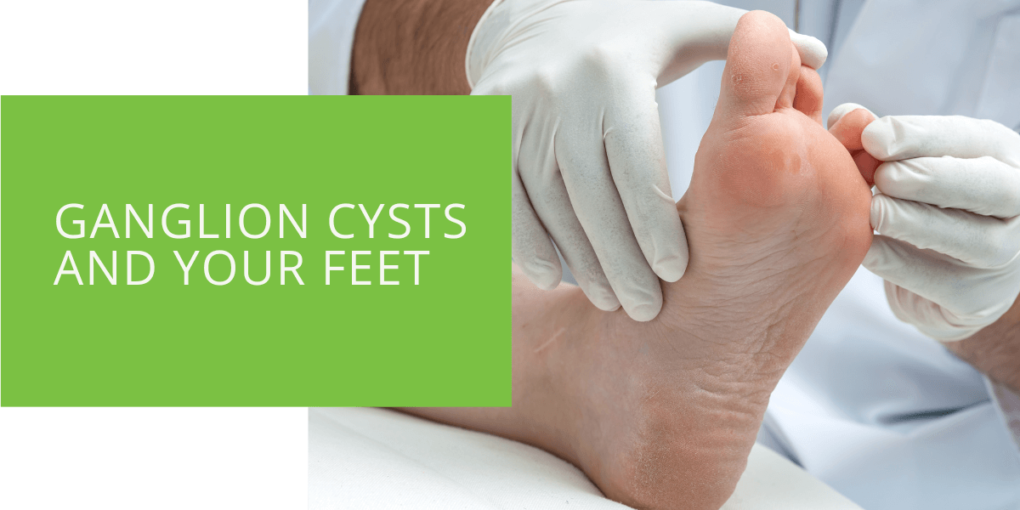 Ganglion Cysts and Your Feet