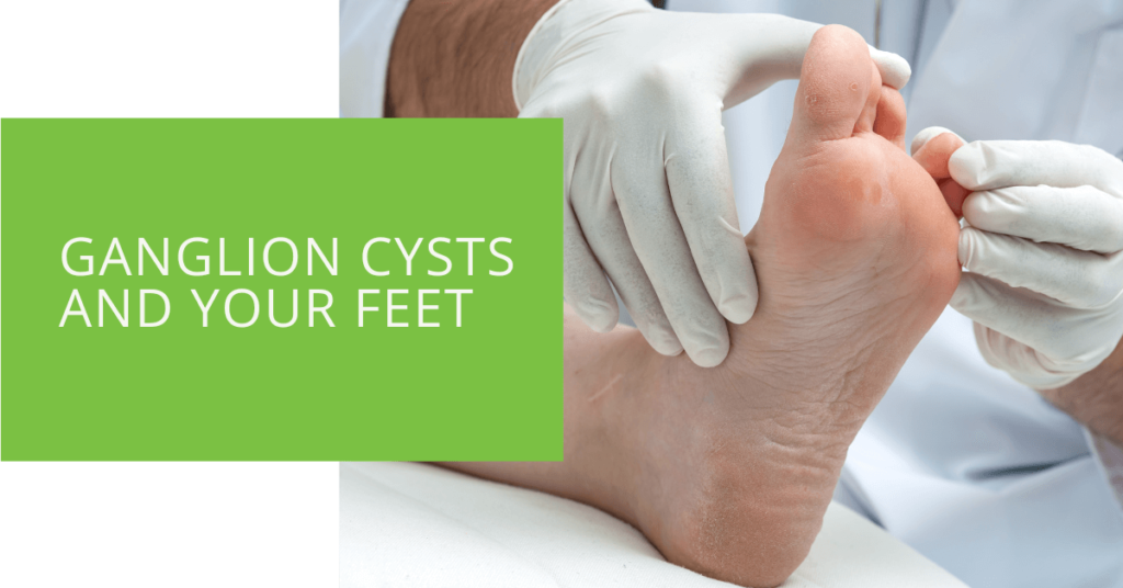 Ganglion Cysts and Your Feet