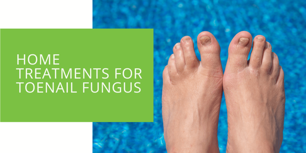 Home Treatments for Toenail Fungus