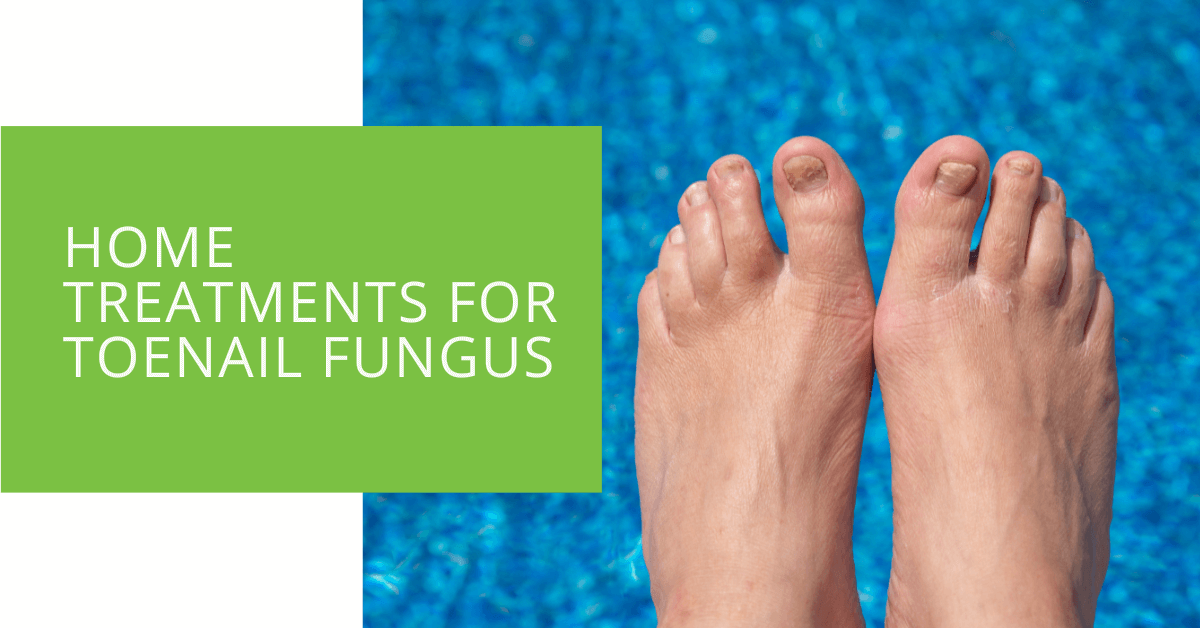Nail fungal infection: Causes, treatment, and symptoms