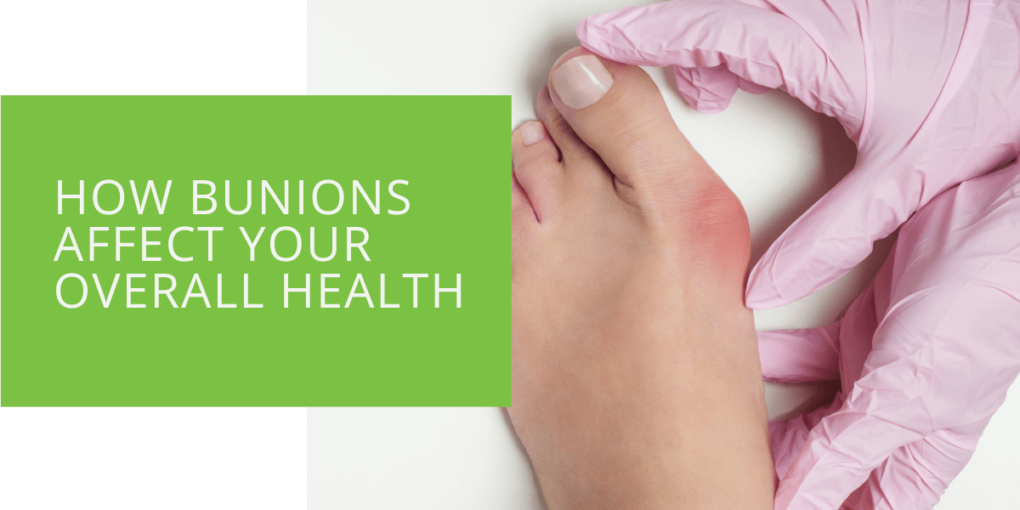How Bunions Affect Your Overall Health