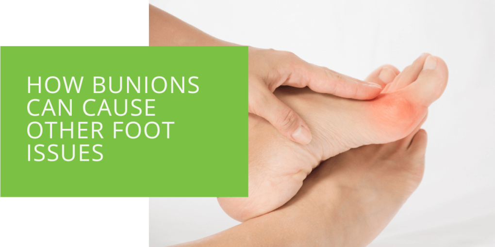 How Bunions Can Cause Other Foot Issues