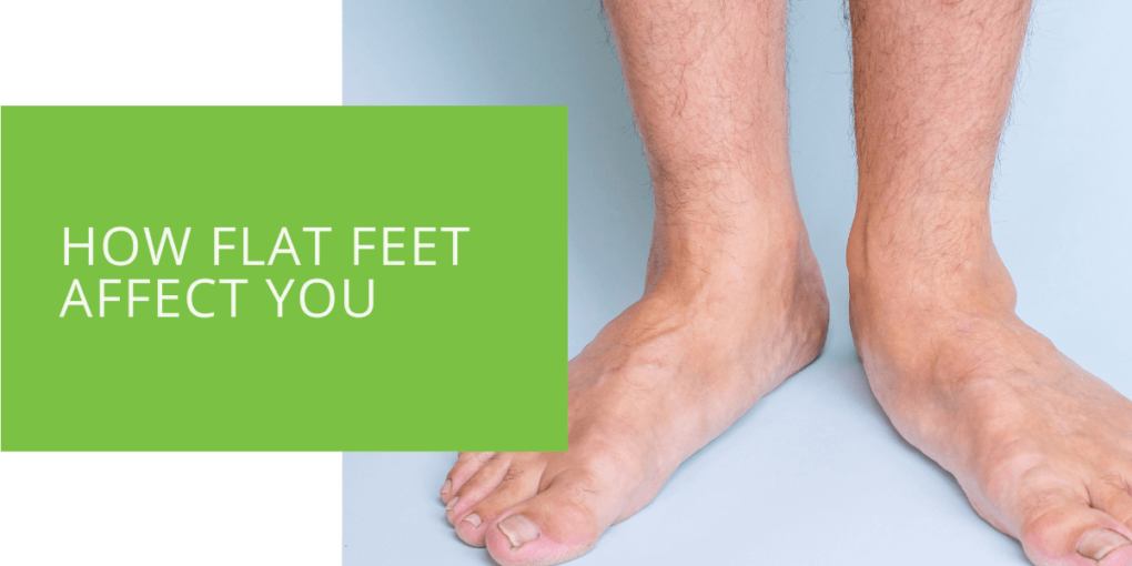 How Flat Feet Affect You