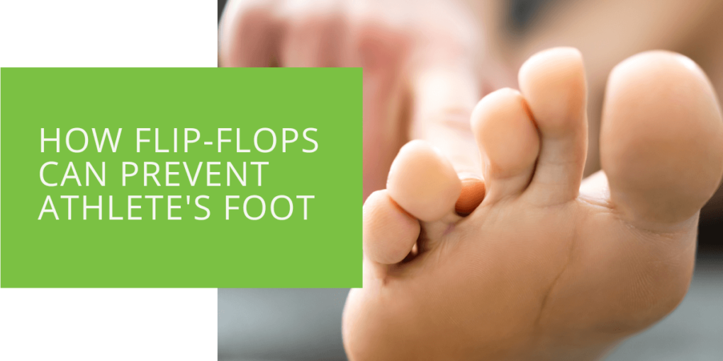 How Flip-Flops Can Prevent Athlete's Foot