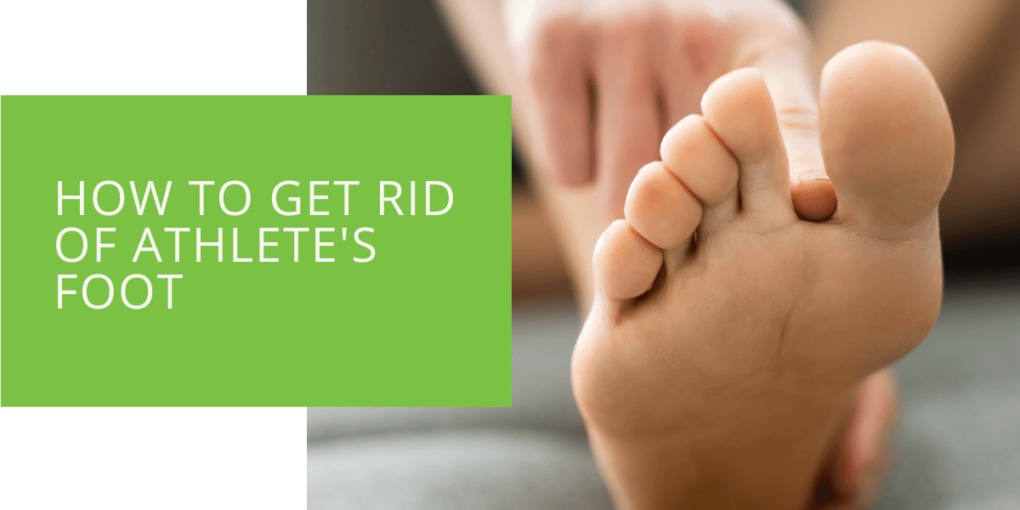 How to Get Rid of Athlete's Foot