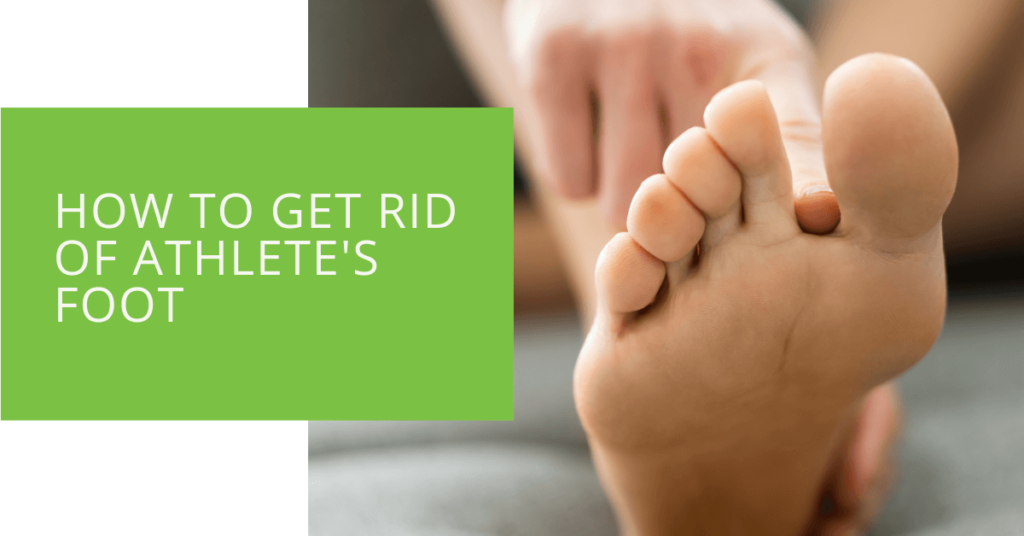 How to Get Rid of Athlete's Foot