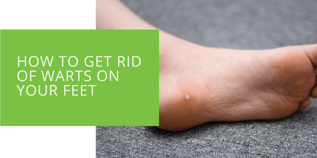 How to Get Rid of Warts on Your Feet