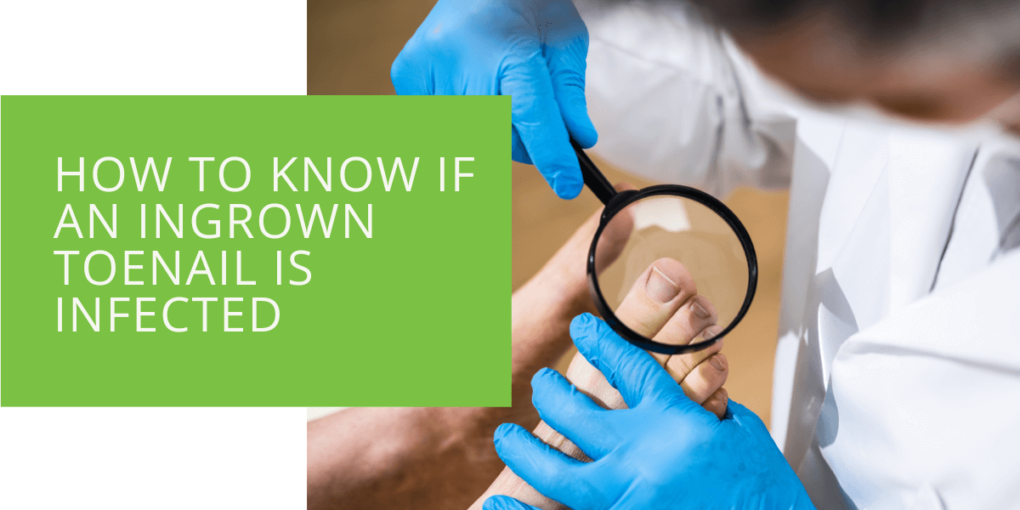 How to Know if an Ingrown Toenail is Infected