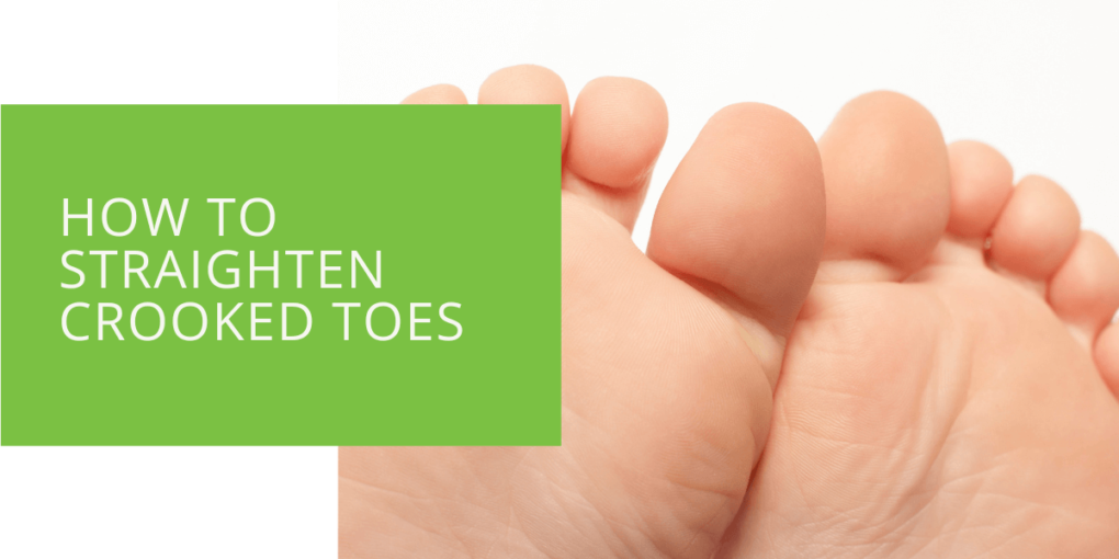 How to Straighten Crooked Toes