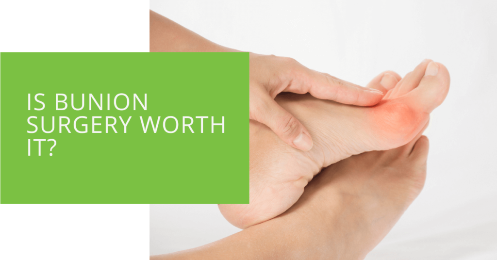 Is Bunion Surgery Worth It