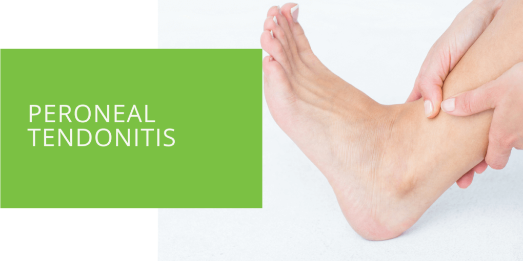 Peroneal Tendonitis