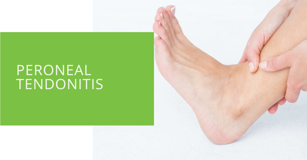 Peroneal Tendonitis