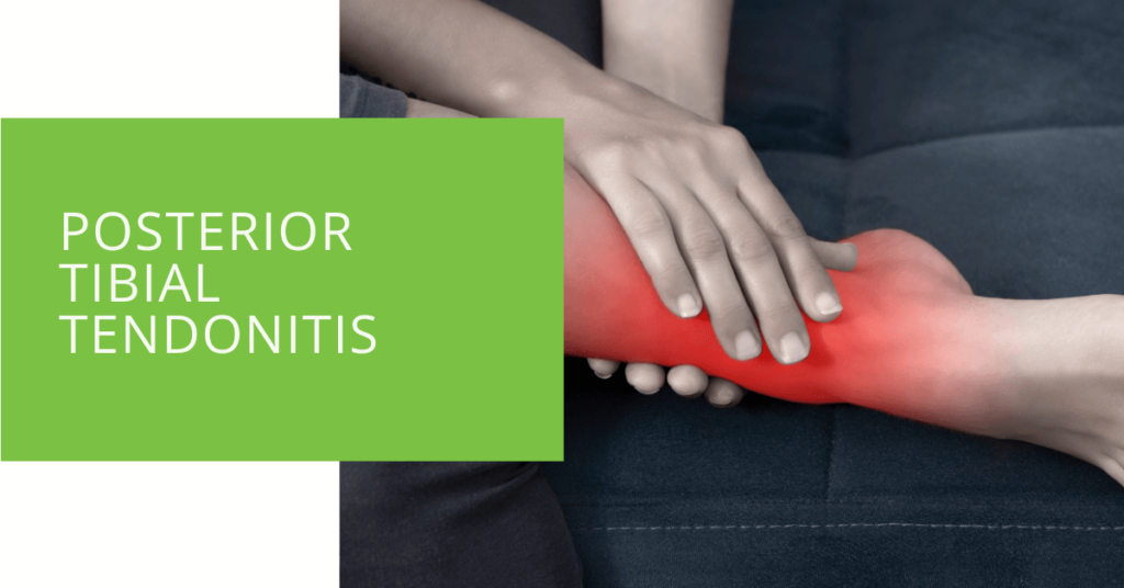 Posterior Tibial Tendonitis