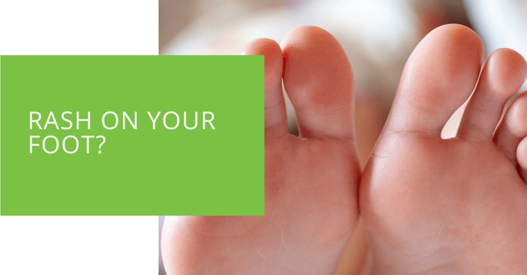 Rash on Your Foot