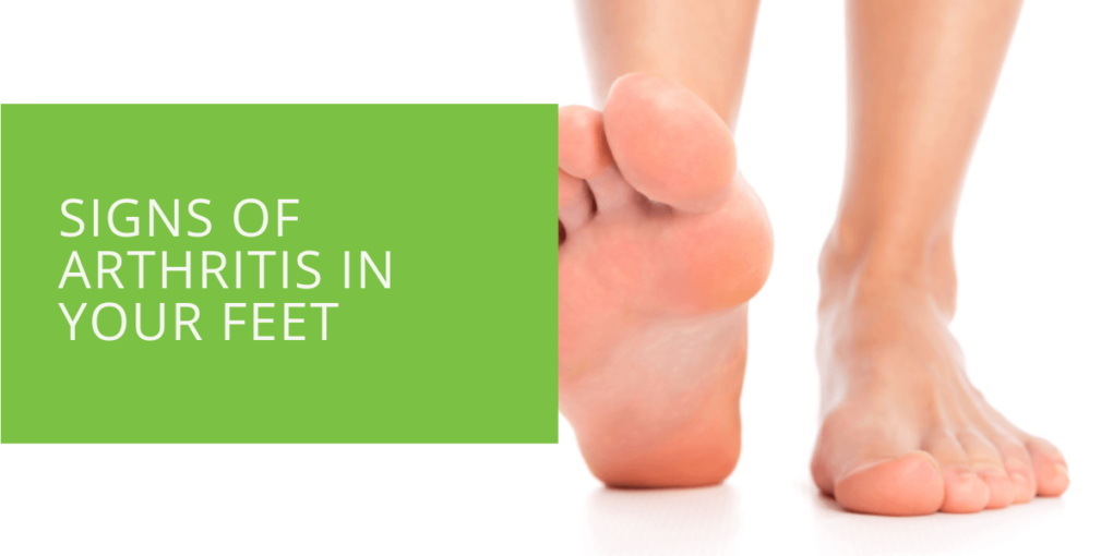 Signs of Arthritis in Your Feet