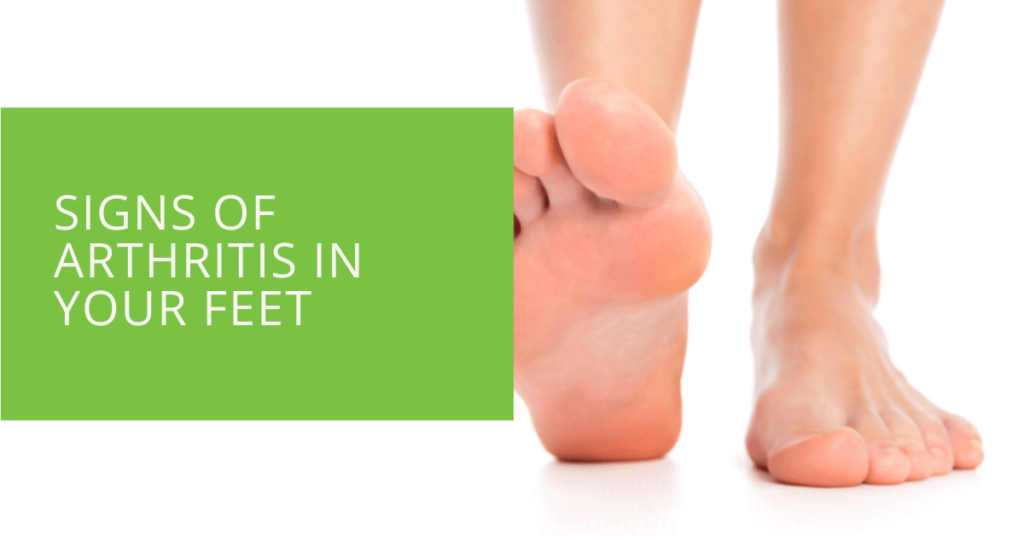 Signs of Arthritis in Your Feet