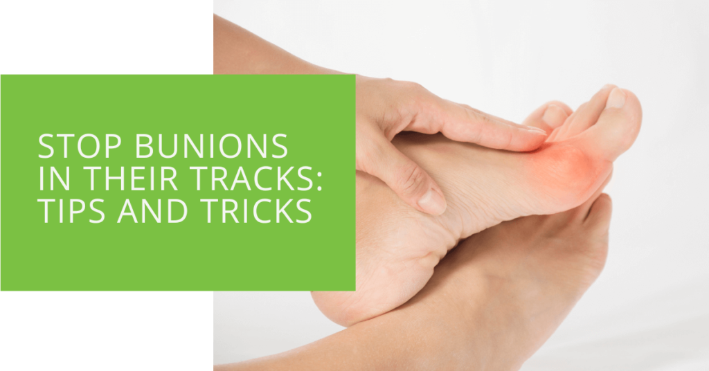 Stop Bunions in Their Tracks Tips and Tricks
