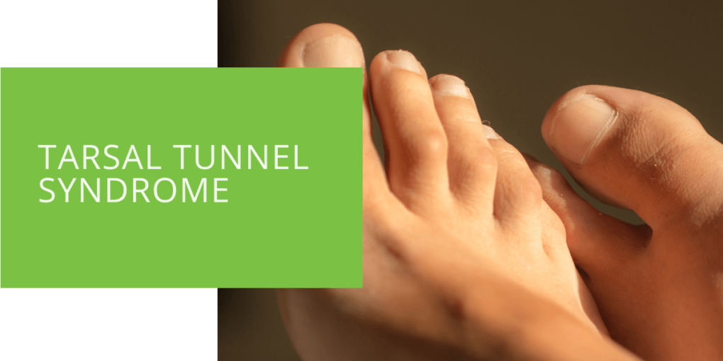 Tarsal Tunnel Syndrome