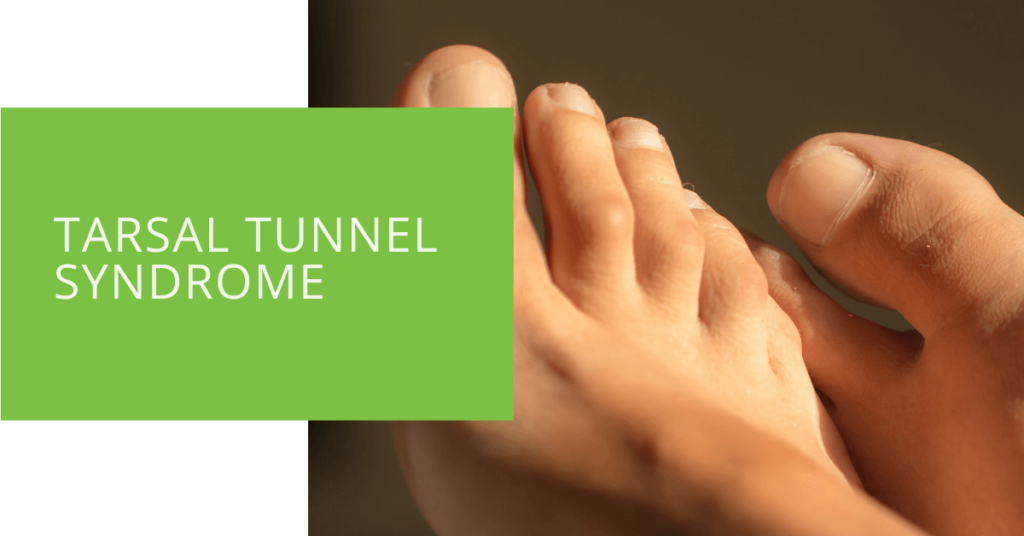 Tarsal Tunnel Syndrome