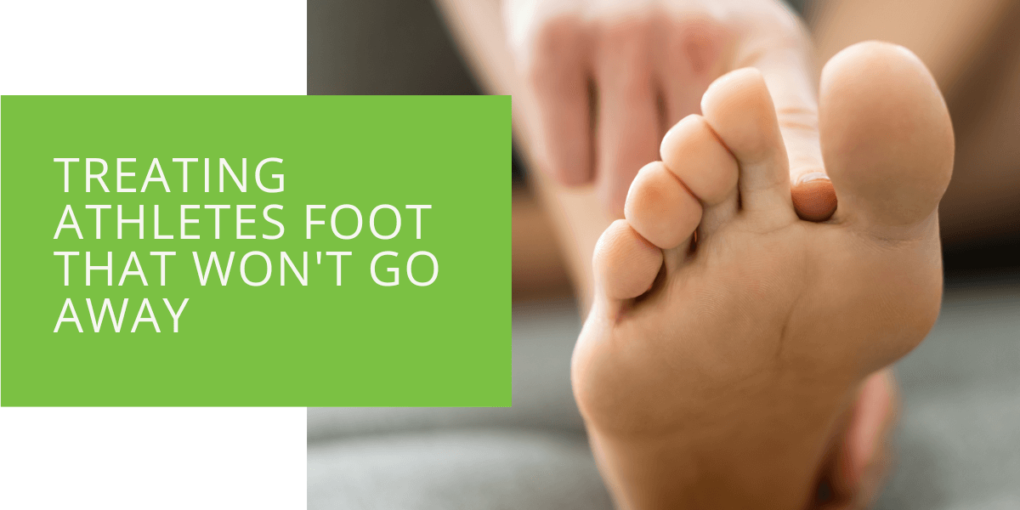 Treating Athletes Foot That Won't Go Away