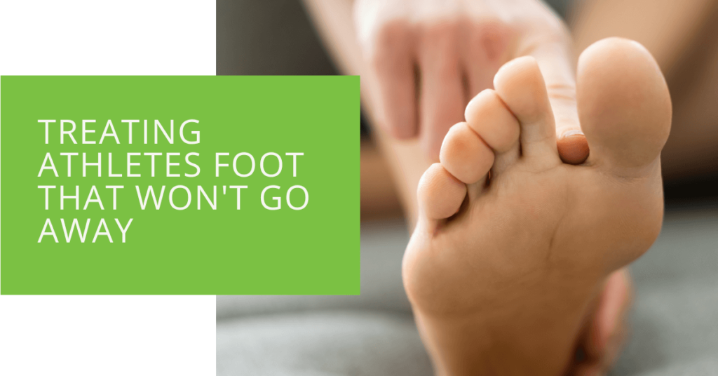 Treating Athletes Foot That Won't Go Away