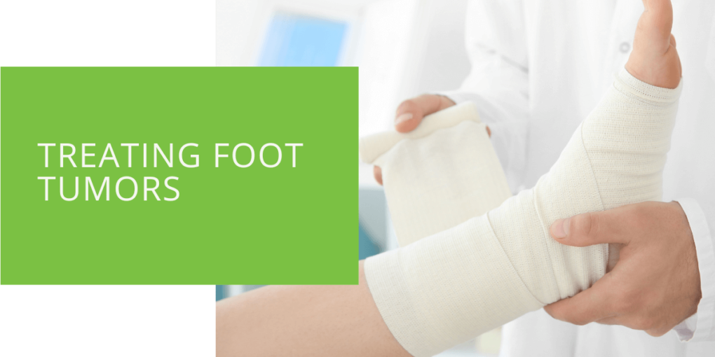 Treating Foot Tumors