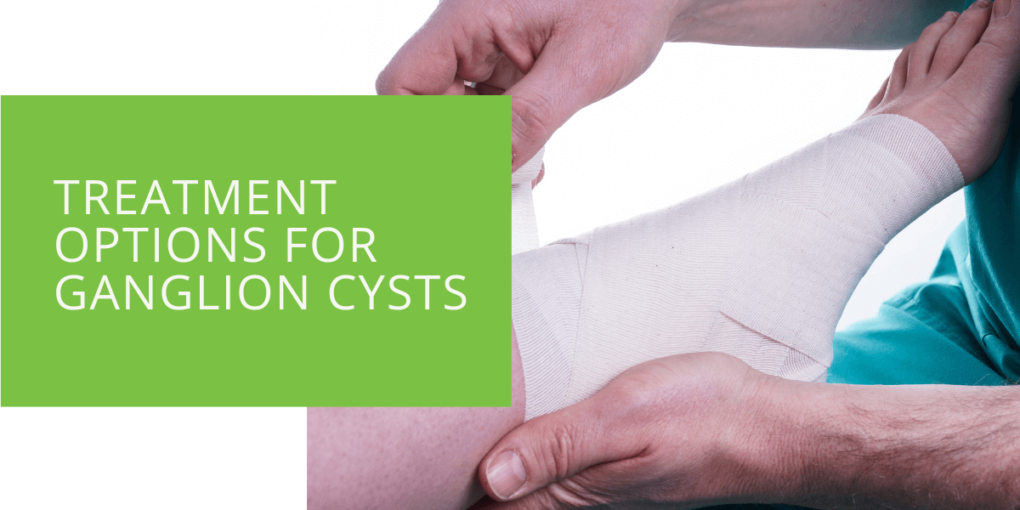 Treatment Options for Ganglion Cysts