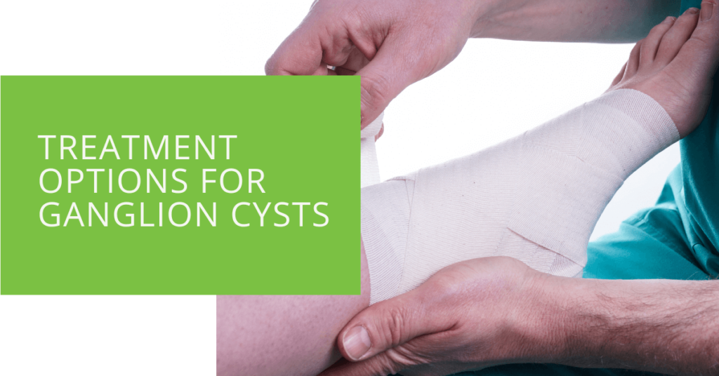 Treatment Options for Ganglion Cysts