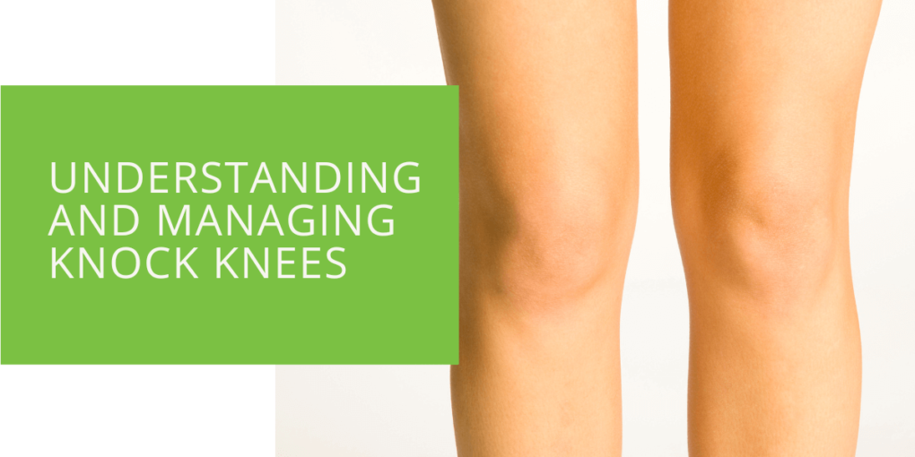 Understanding and Managing Knock Knees