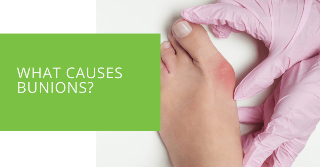What Causes Bunions