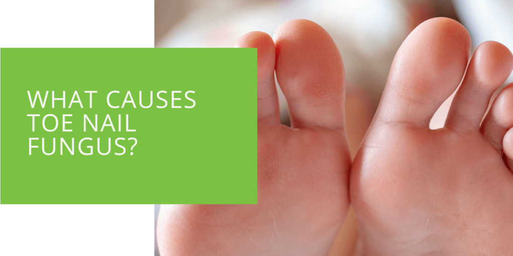 What Causes Toe Nail Fungus