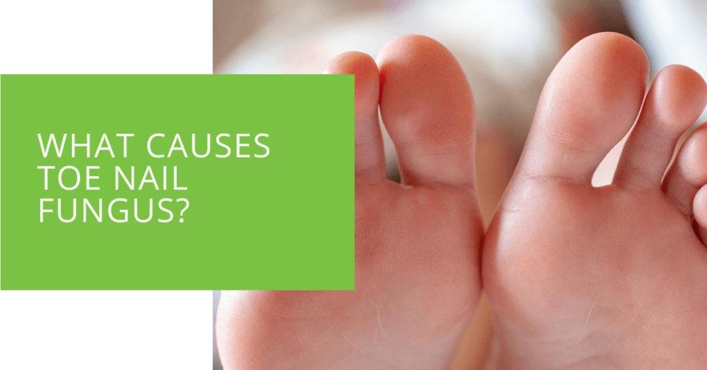 What Causes Toe Nail Fungus
