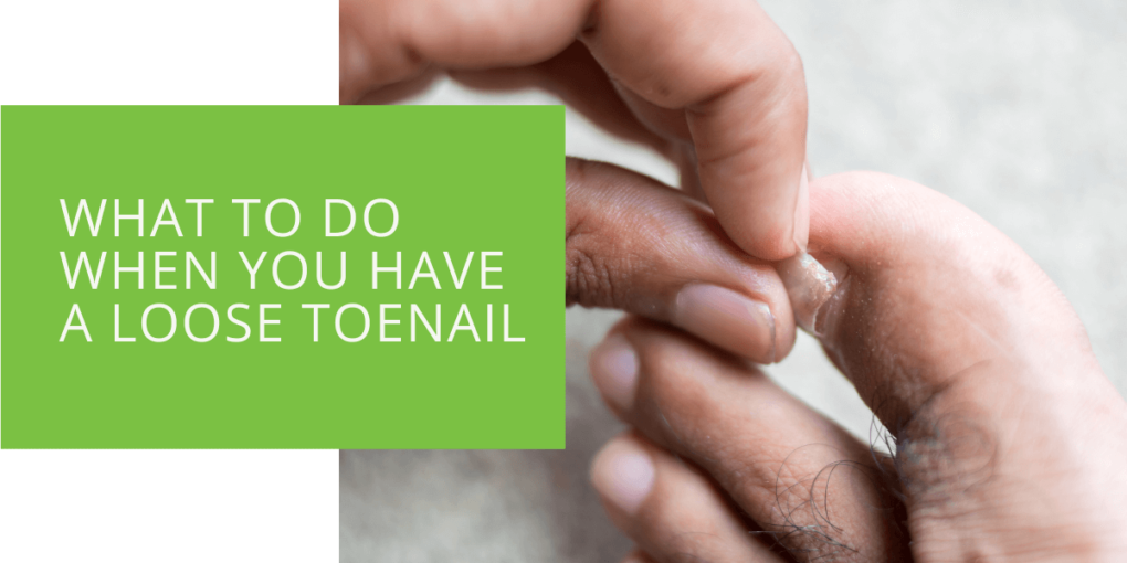 What to Do When You Have a Loose Toenail