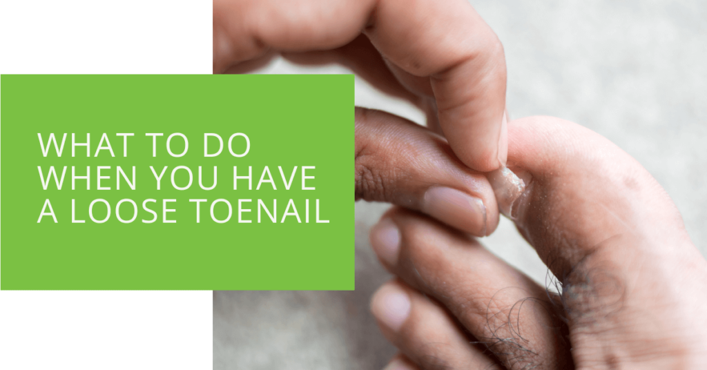 What to Do When You Have a Loose Toenail