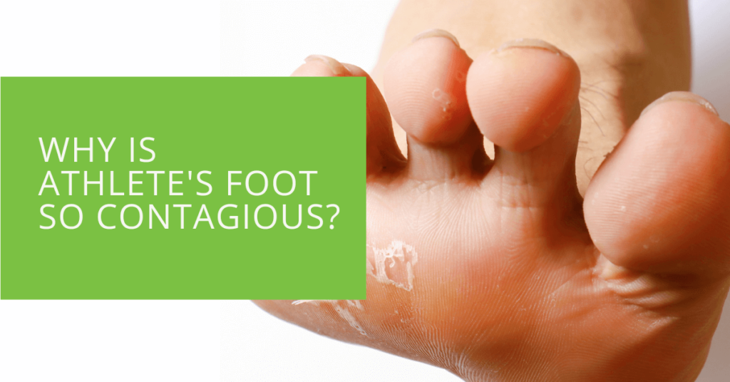 Why Is Athlete's Foot So Contagious
