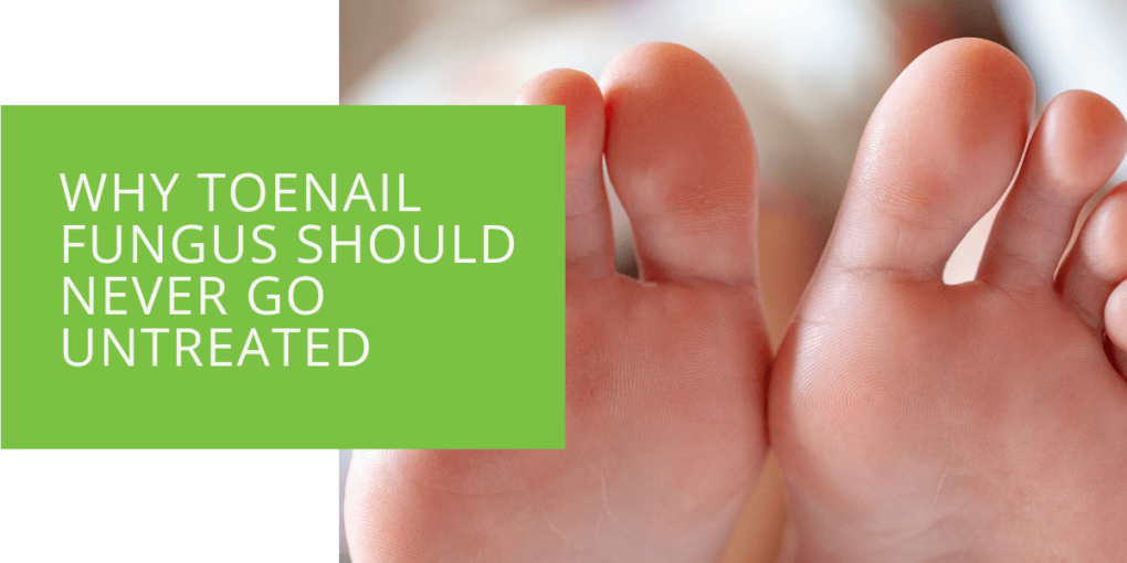 Why Toenail Fungus Should Never Go Untreated