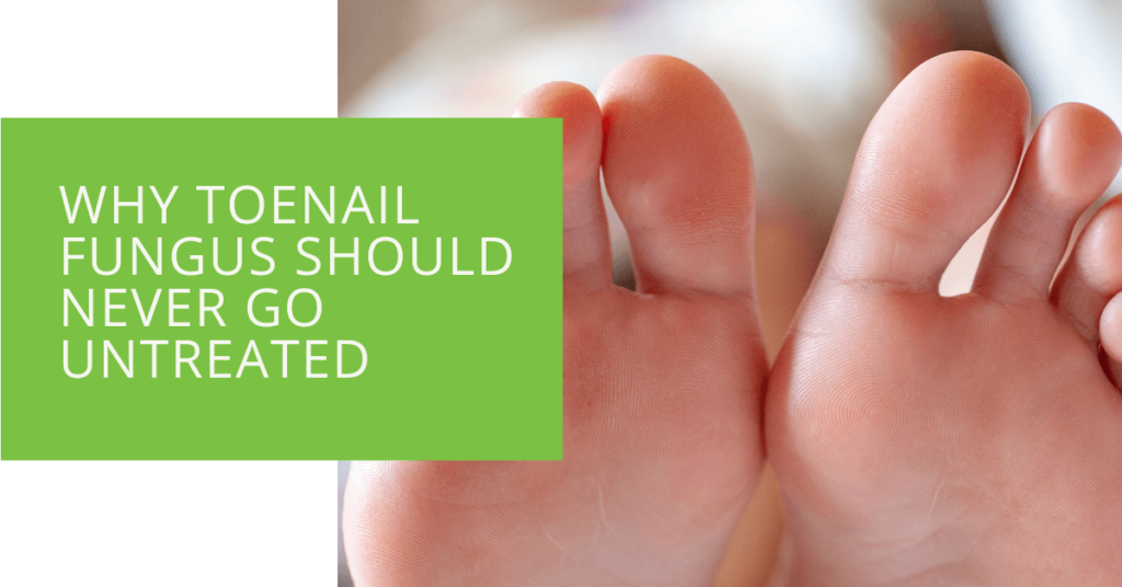 Why Toenail Fungus Should Never Go Untreated