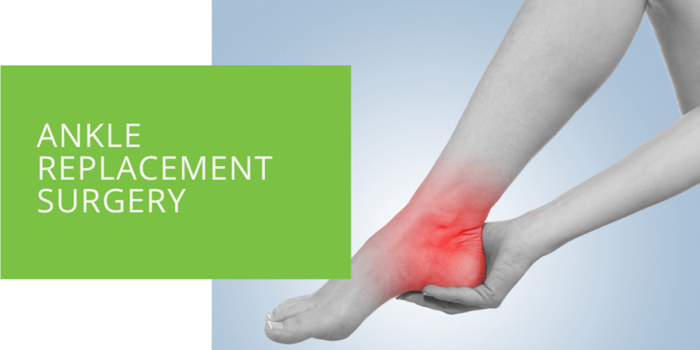 Ankle Replacement Surgery