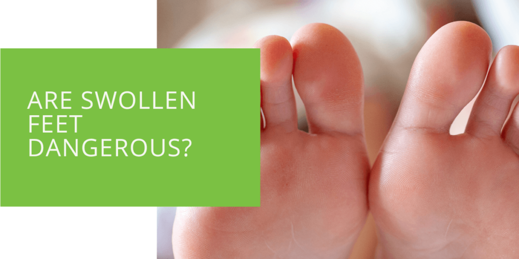 Are Swollen Feet Dangerous