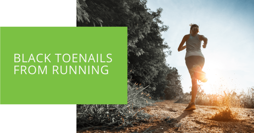Black Toenails from Running