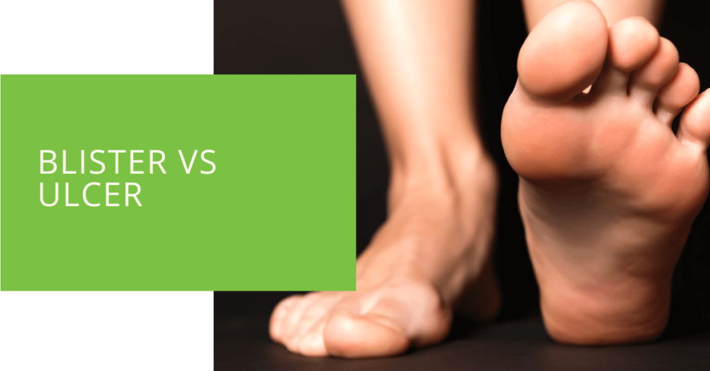 Blister vs Ulcer