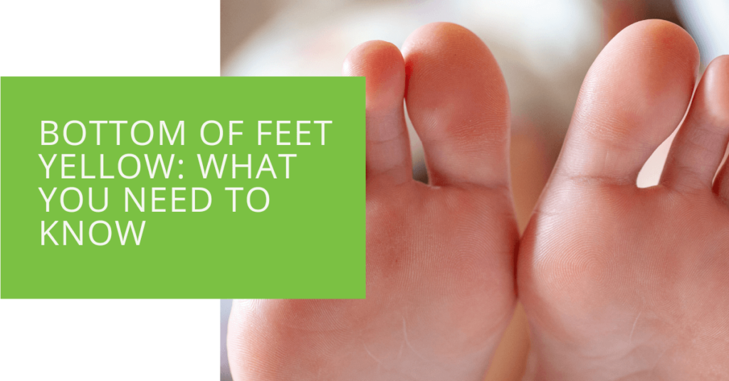 Bottom of Feet Yellow What You Need to Know