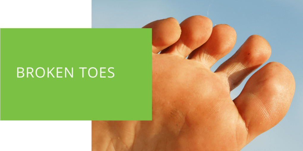Broken Toes