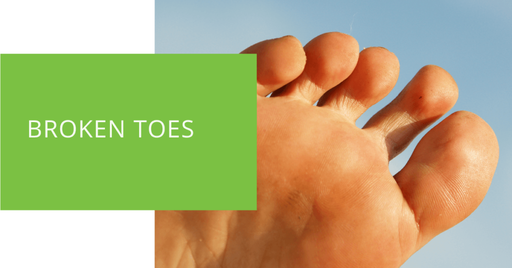 Broken Toes
