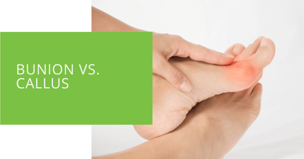 Bunion vs. Callus