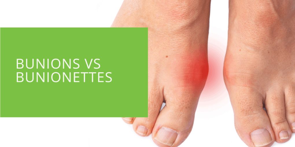 Bunions vs Bunionettes