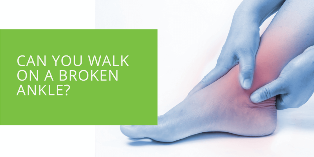 Can You Walk on a Broken Ankle