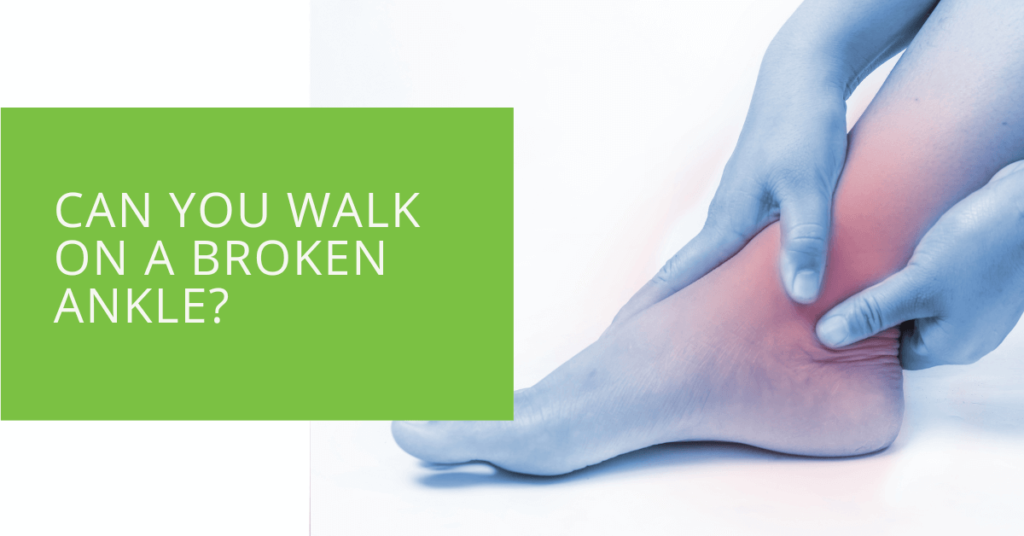 Can You Walk on a Broken Ankle
